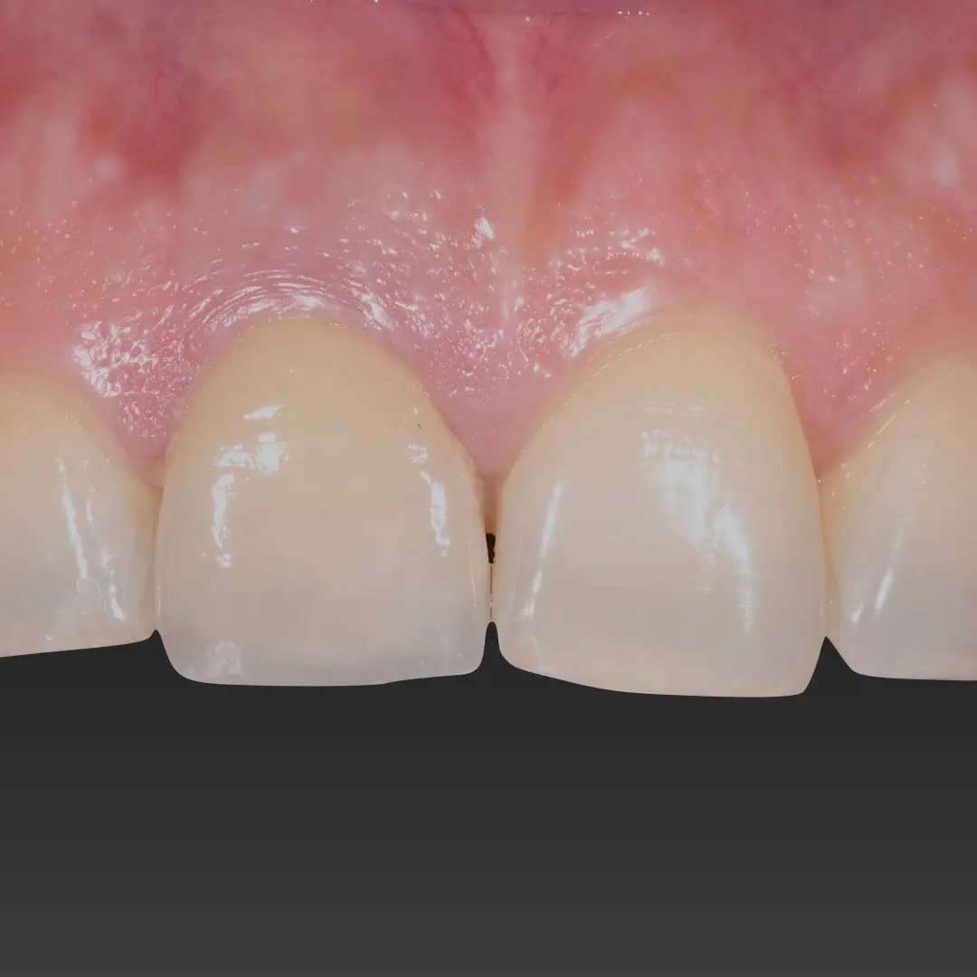Studio dentistico GTF - casi clinici