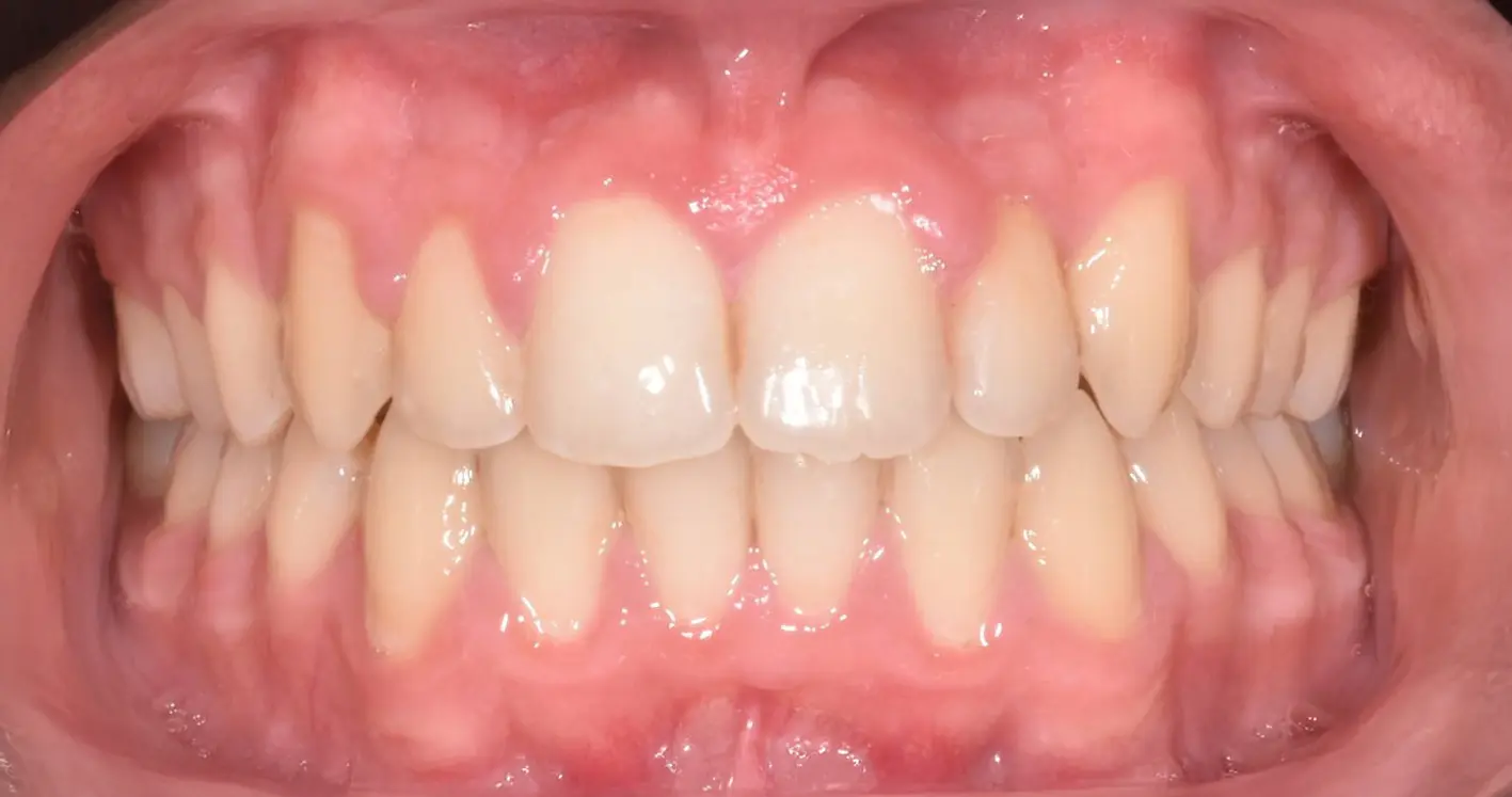 Studio dentistico GTF - casi clinici