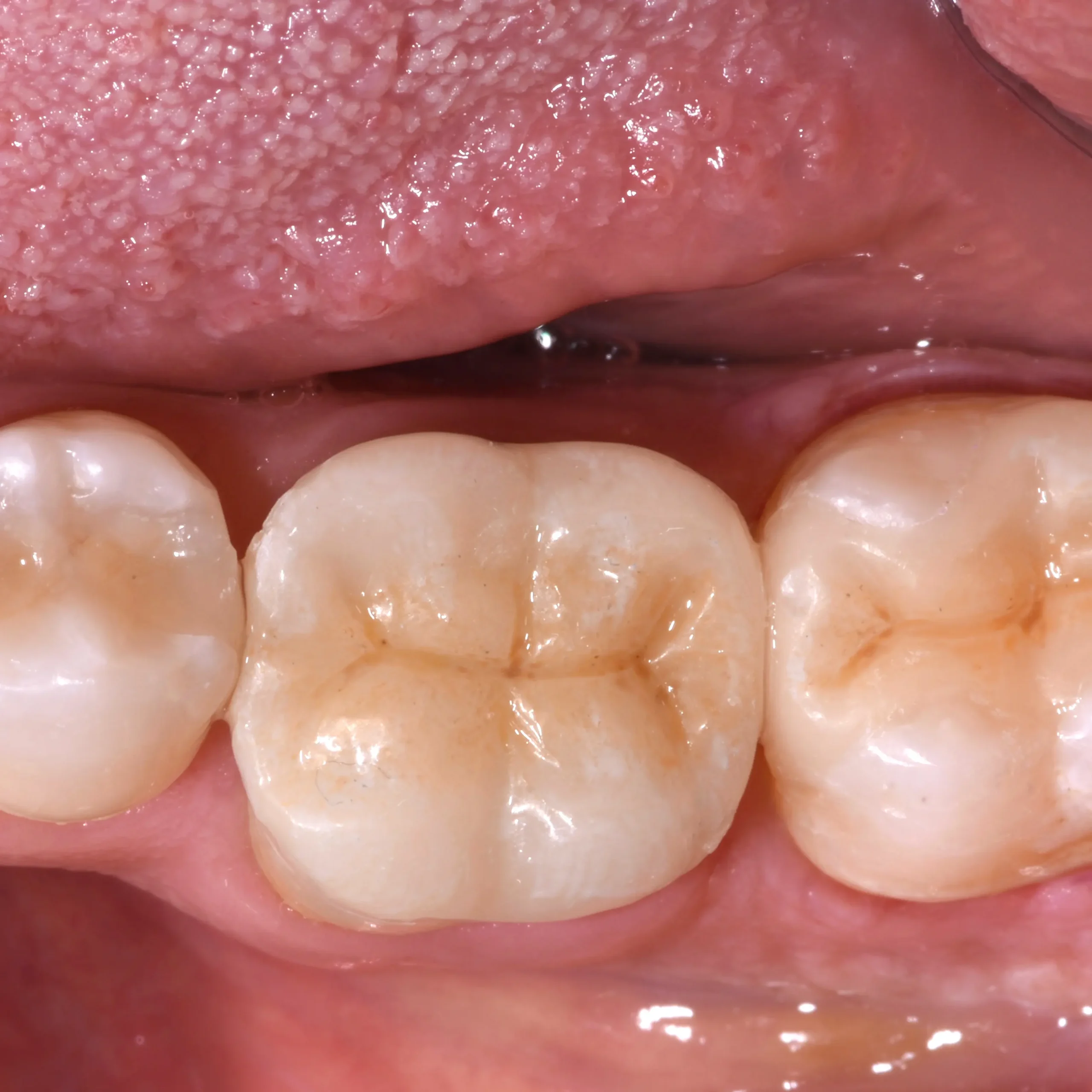 Studio dentistico GTF - casi clinici