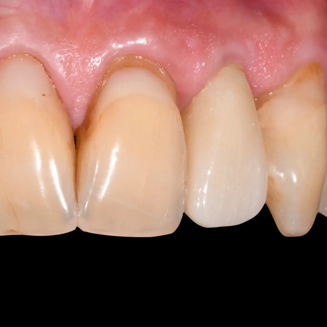 Studio dentistico GTF - casi clinici