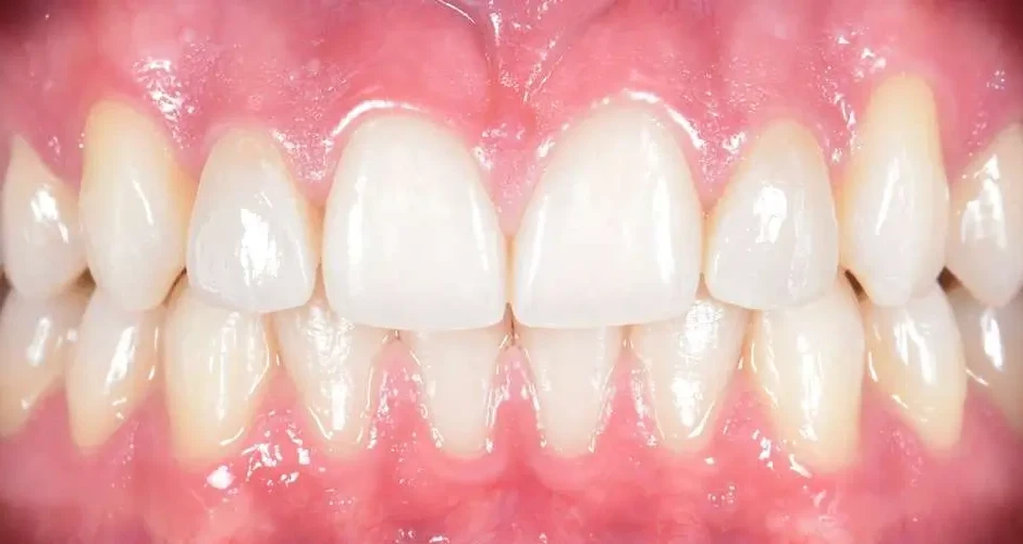 Studio dentistico GTF - casi clinici